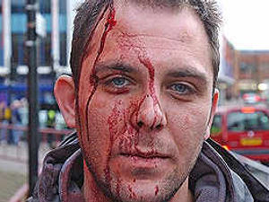 Supporting image for story: Football violence photos