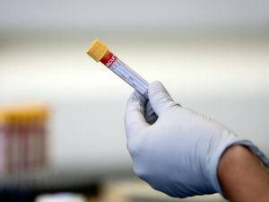 Supporting image for story: Another five Covid deaths announced in Shropshire