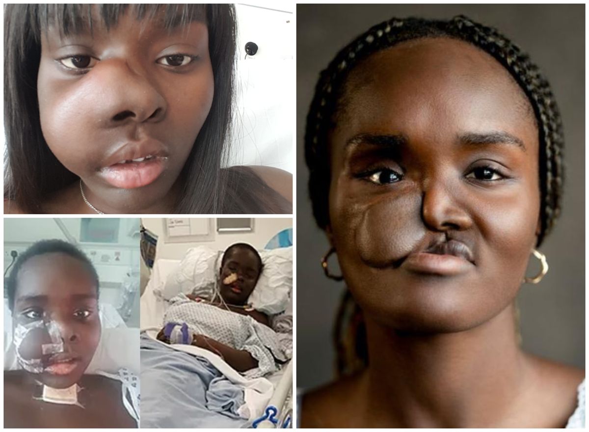 'Hannah Montana made me want to be an actress - bone cancer didn't stop me chasing my dreams on the Birmingham stage'