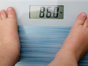 Supporting image for story: There are now 124 million obese children around the world, figures show