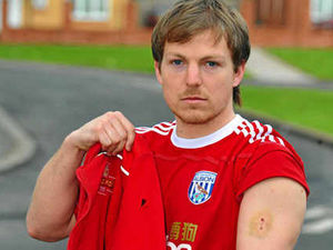 Supporting image for story: Postman attacked by dog demands action