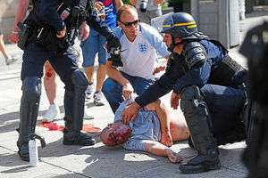 An man injured in clashes is assisted by police in Marseille
