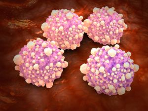 Supporting image for story: Mouth bacteria may increase pancreatic cancer risk threefold, experts say