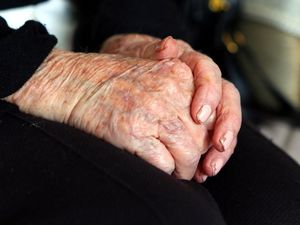 Supporting image for story: Gum disease bug could play key role in Alzheimer’s, research suggests