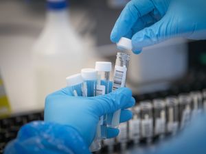 Supporting image for story: Record number of people in UK with long Covid, survey suggests