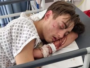 Supporting image for story: Father's heartfelt plea to find hit-and-run driver who left his son with brain trauma