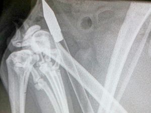 Supporting image for story: Cruel crossbow yob shoots cat in Kingswinford