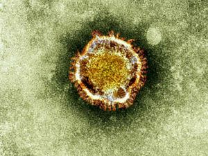 Supporting image for story: Star comment: Glimmer of hope for an end to pandemic?