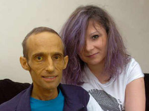 Supporting image for story: Groom loses battle against rare cancer