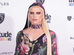 Supporting image for story: Drag Race’s Bimini reveals hair transplant: I feel vulnerable but I’m owning it