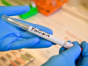 Supporting image for story: Chronic diseases and public health failures fuelling Covid-19 deaths – study