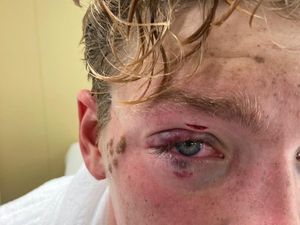 Supporting image for story: 'I thought I’d lost an eye!' Shropshire marathon swimmer elbowed out of Olympic race