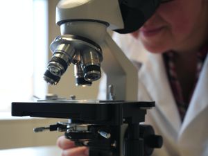 Supporting image for story: ‘Encouraging’ results in drug trial that stops cancer cells from repairing DNA