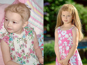 Supporting image for story: Gift of hair a lifeline to cancer children