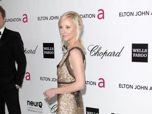 Supporting image for story: Anne Heche ‘not expected to survive’ following fiery LA car crash, family says