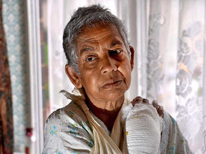 Supporting image for story: Dudley grandmother's arm broken as thief grabs bag