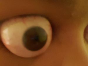 Supporting image for story: A woman who can pop her eyes out of her head has answered the internet’s questions