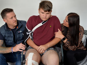 Supporting image for story: Family wants justice after son, 15, suffers horrific leg break in alleged Cannock attack - with VIDEO