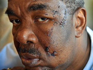 Supporting image for story: Pitbull savages Wolverhampton cyclist in horror attack