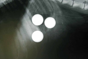 The X-ray highlights Azars problem