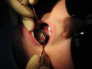 Supporting image for story: Wrong tooth pulled out in Shropshire ‘never event’