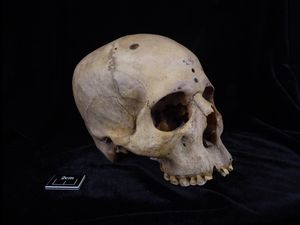 Supporting image for story: Ancient Egyptians ‘were trying to understand and treat cancer 4,000 years ago’