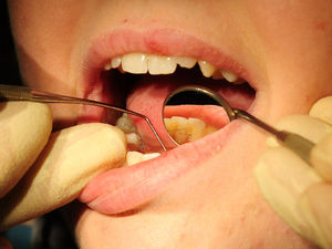 Supporting image for story: Shropshire dentists make thousands of extra urgent appointments available