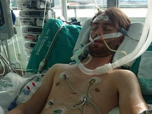 Supporting image for story: Telford woman's joy as brain-damaged brother starts to speak
