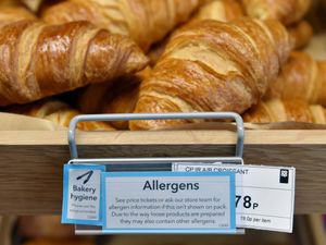 Supporting image for story: Around 6% of adults have food allergy, report finds