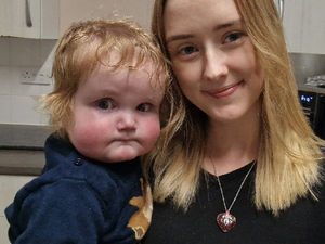 Supporting image for story: Major milestone reached as £1 million raised to help send Shropshire infant to the US for life-saving surgery