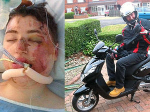 Supporting image for story: Declan Osborne home from hospital after moped crash
