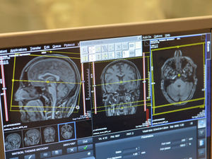 Supporting image for story: Mobility expert to speak at Shrewsbury brain injury forum