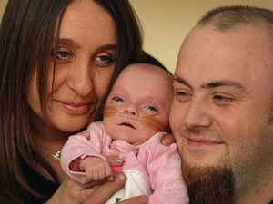 Supporting image for story: 21oz baby Savannah back home after being born 11 weeks early