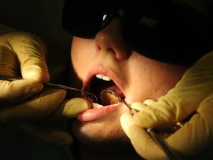 Supporting image for story: Toothbrushes for children have become ‘luxury’ item for some families