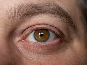 Supporting image for story: Drug for rare disease that causes sudden vision loss available on NHS in England