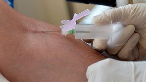 Supporting image for story