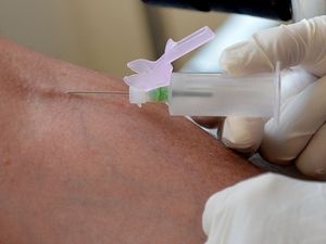 Supporting image for story: Blood test that detects cancer years ahead of symptoms 'could revolutionise treatment'