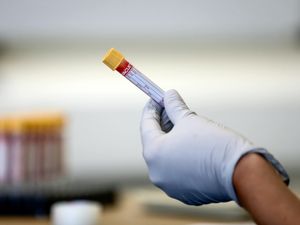 Supporting image for story: Two coronavirus deaths reported in Staffordshire and Birmingham hospital and one in care home