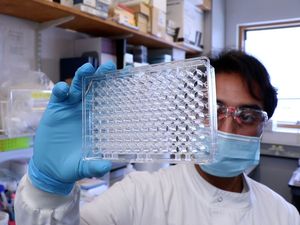 Supporting image for story: Scientists develop ‘game-changing’ antibody tests to detect new Covid variants