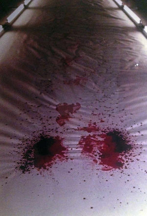 The focus of the exhibition is said to be on the endurance, vulnerability and fragility of the body