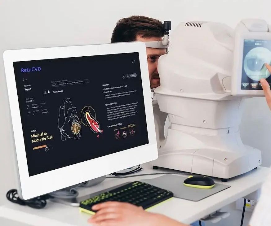 Retinal Scan 