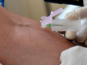 Supporting image for story: Blood test for chronic fatigue syndrome may be on its way