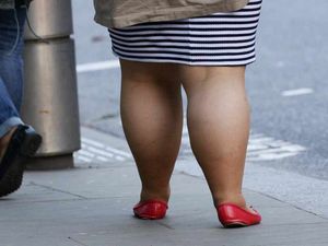 Supporting image for story: Obesity on the rise in Shropshire, warns health body
