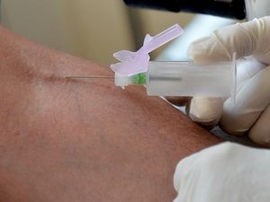 Supporting image for story: Blood test could track immune response to coronavirus, researchers say