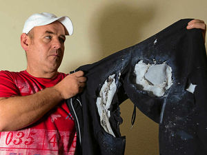 Supporting image for story: Wednesbury firework victim tells of horror