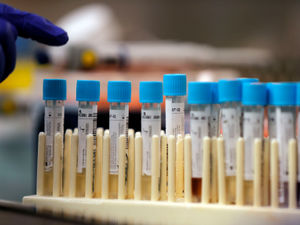 Supporting image for story: Deprivation has stronger link with coronavirus death rates than any ethnicity - health boss