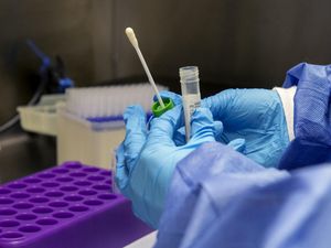 Supporting image for story: Prior Covid-19 infection ‘could offer virus protection for at least six months’