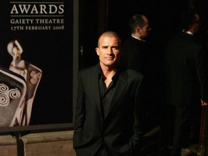 Supporting image for story: Prison Break star Dominic Purcell reveals on-set accident cracked his skull