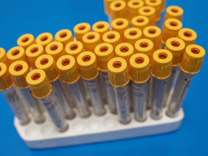 Supporting image for story: Over 1,000 men get vital tests at Bridgnorth prostate screening event