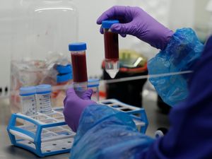 Supporting image for story: Long Covid could be four different syndromes – academics